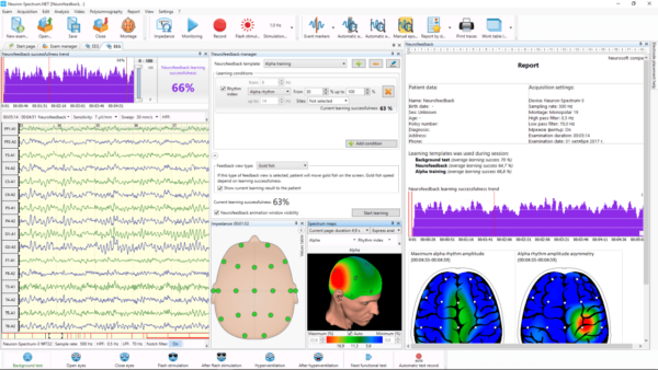 Kit Bio Feedback – Image 3