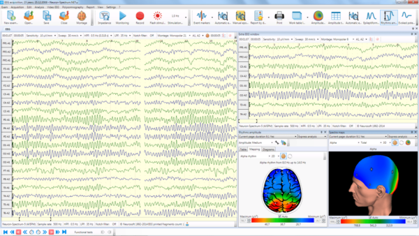 Neuron Spectrum 1 – Image 2