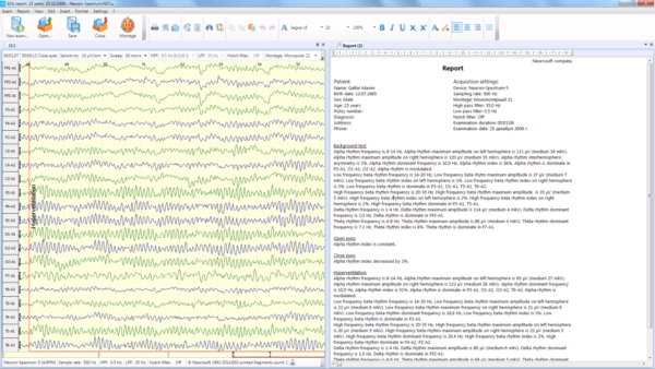 Neuron Spectrum 1 – Image 4
