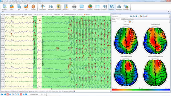 Neuron Spectrum 1 – Image 5