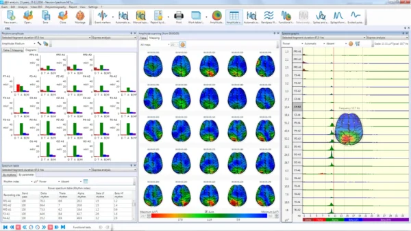 Neuron Spectrum 2 – Image 4