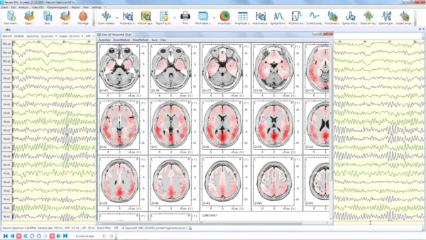Neuron Spectrum 1 – Image 7