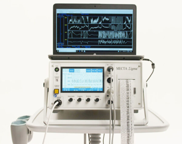 SigmaStim Σigma – Image 2